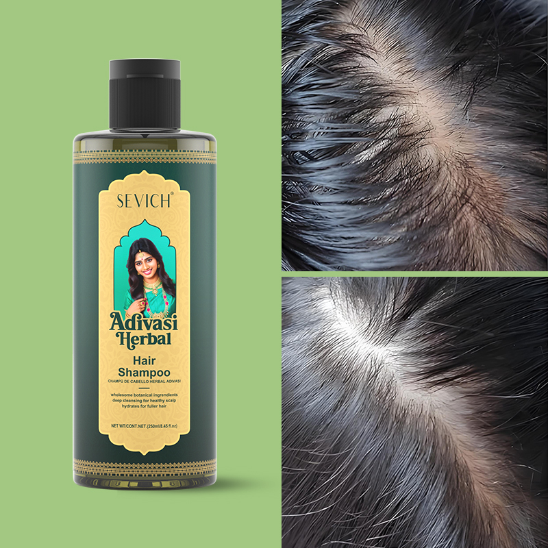 Sevich conjunto de óleo de cre - Hair Care India avaliação e preço